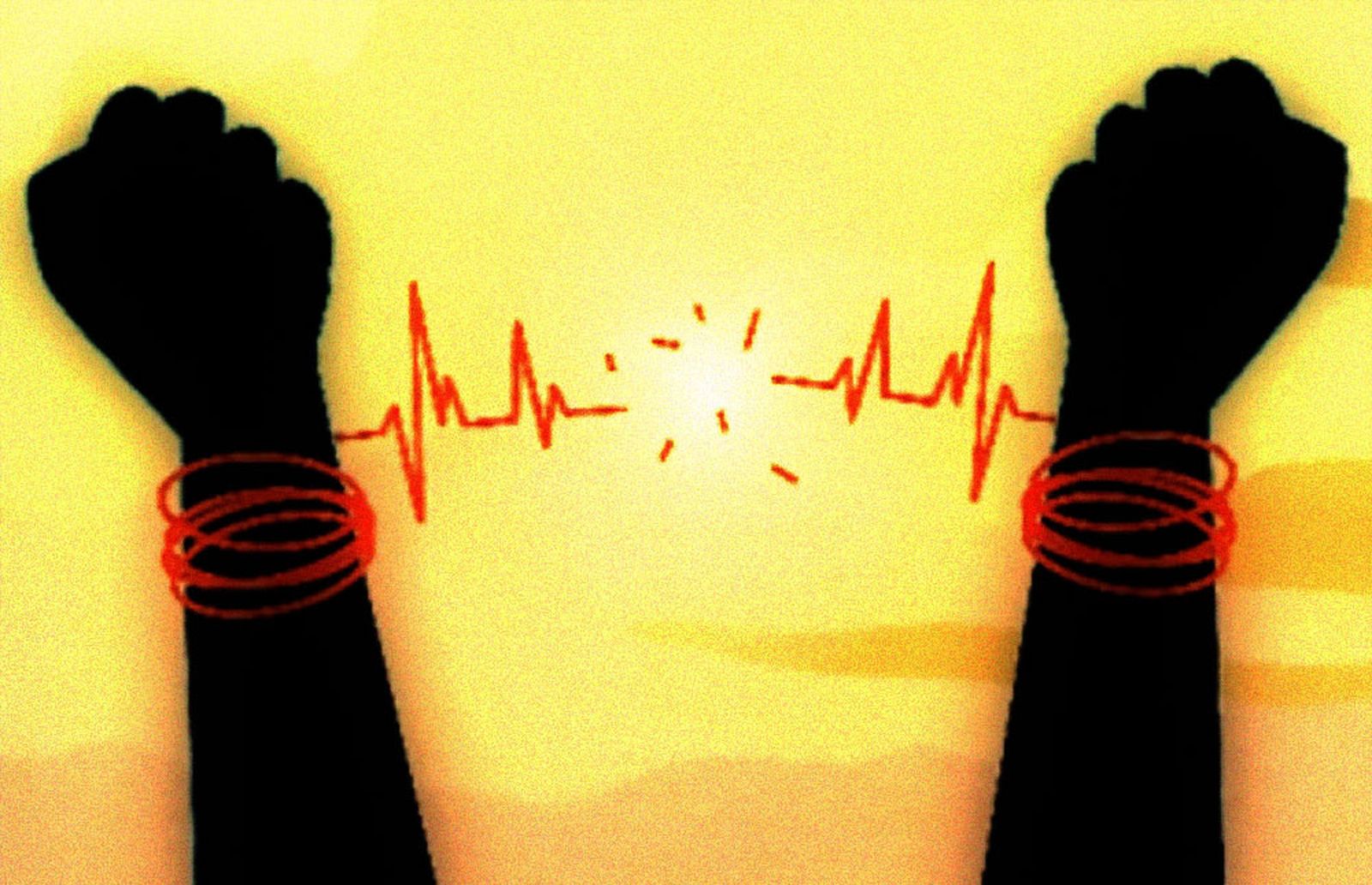 Eutanasia: Exodo 152