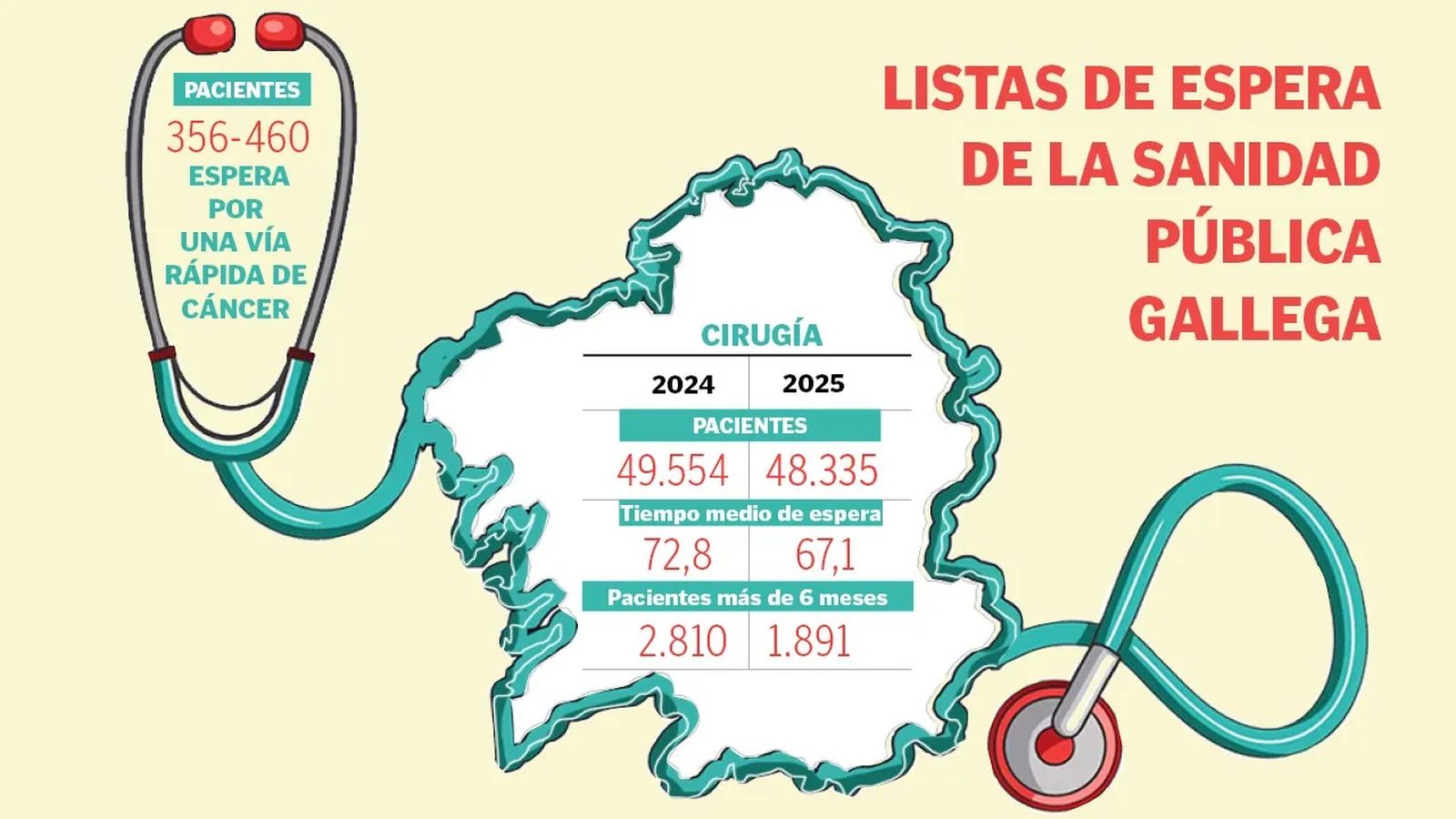 Listas de espera en la sanidad Gallega