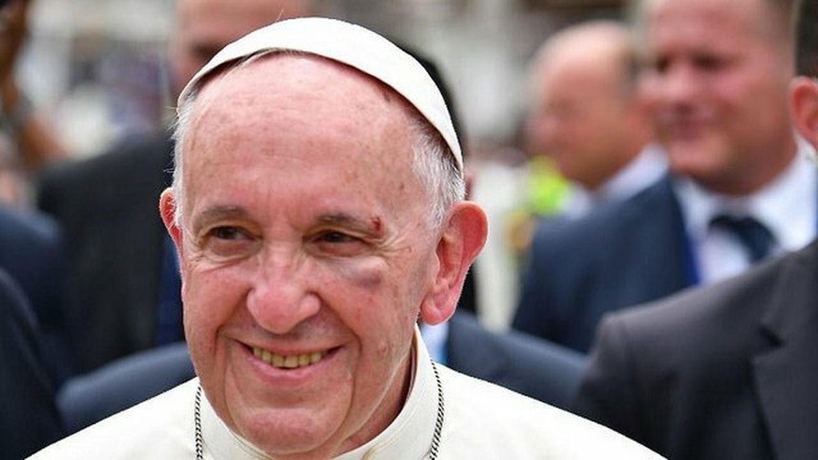 El Papa Francisco y la Iglesia accidentada