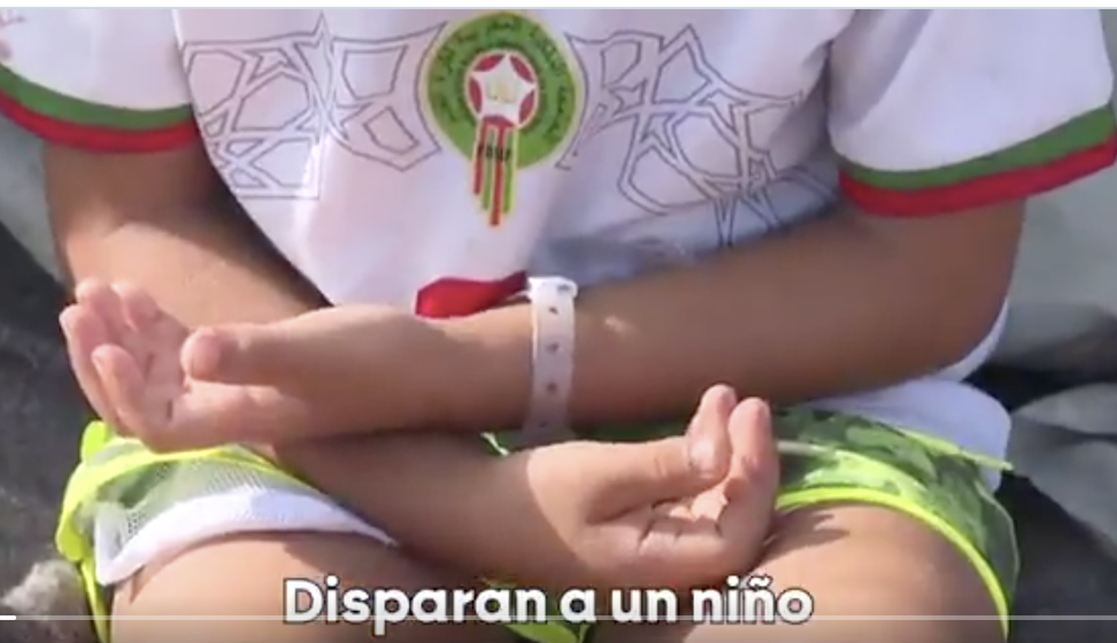 Imagen de Alí, el niño marroquí a quien disparon con perdigones