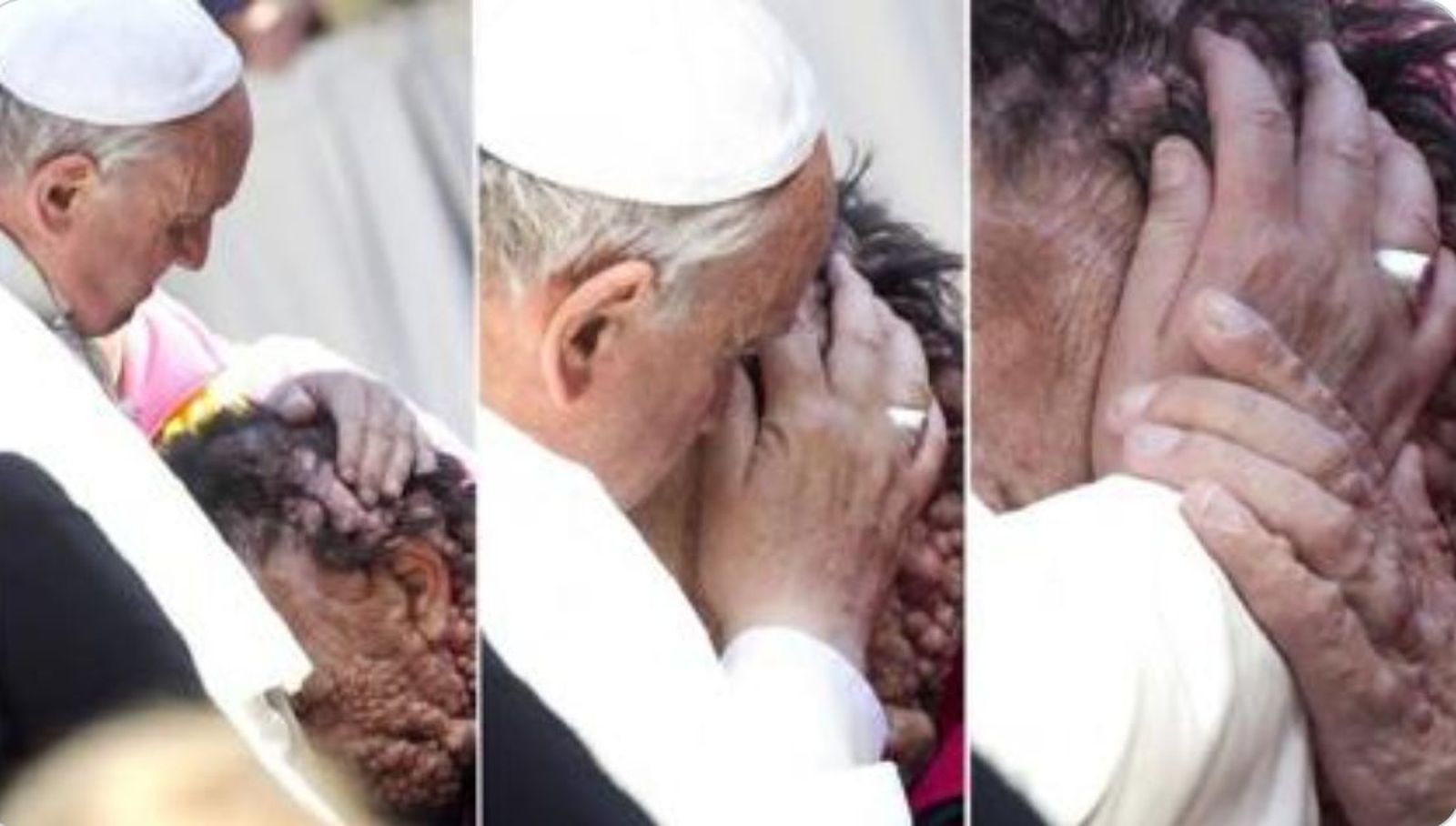 El Papa y el enfermo