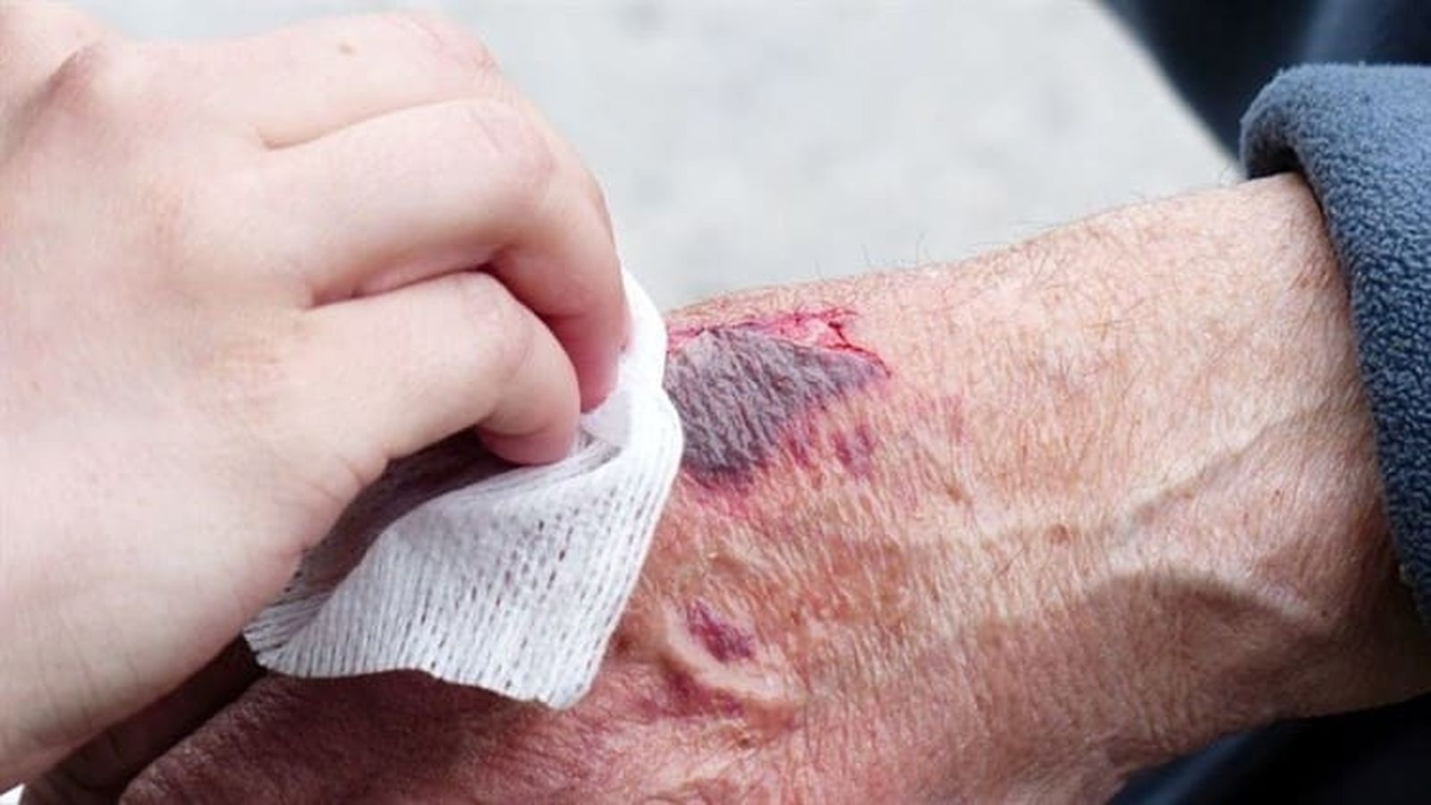 La “tarjeta informativa” del arzobispado de México: Si rascas esa costra, saldrá mucha pus…