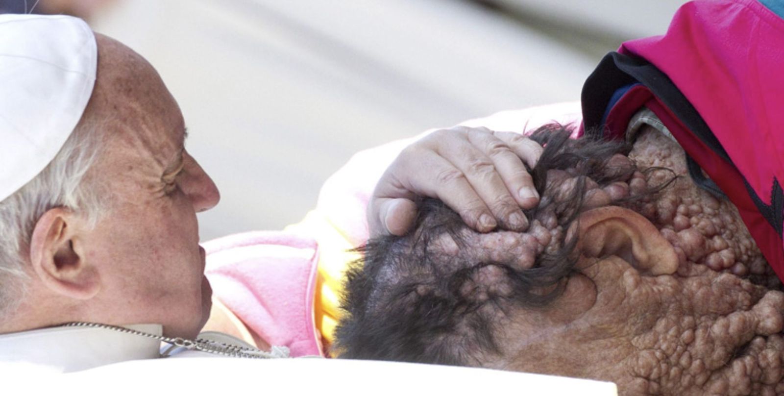 El Papa y el enfermo