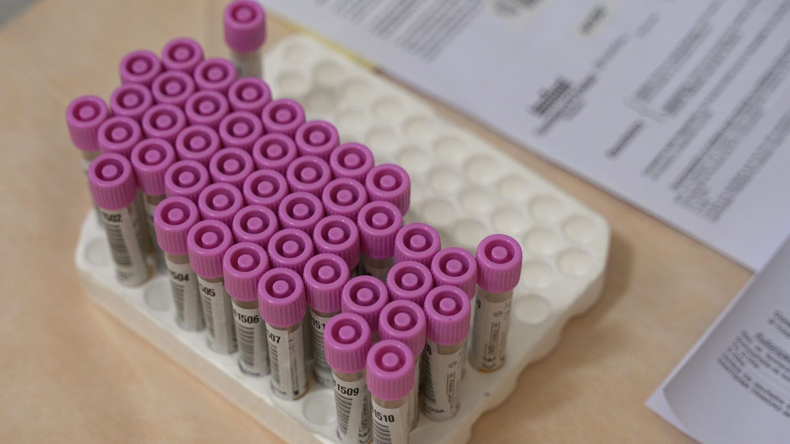 Pruebas PCR al Personal de la UPSA