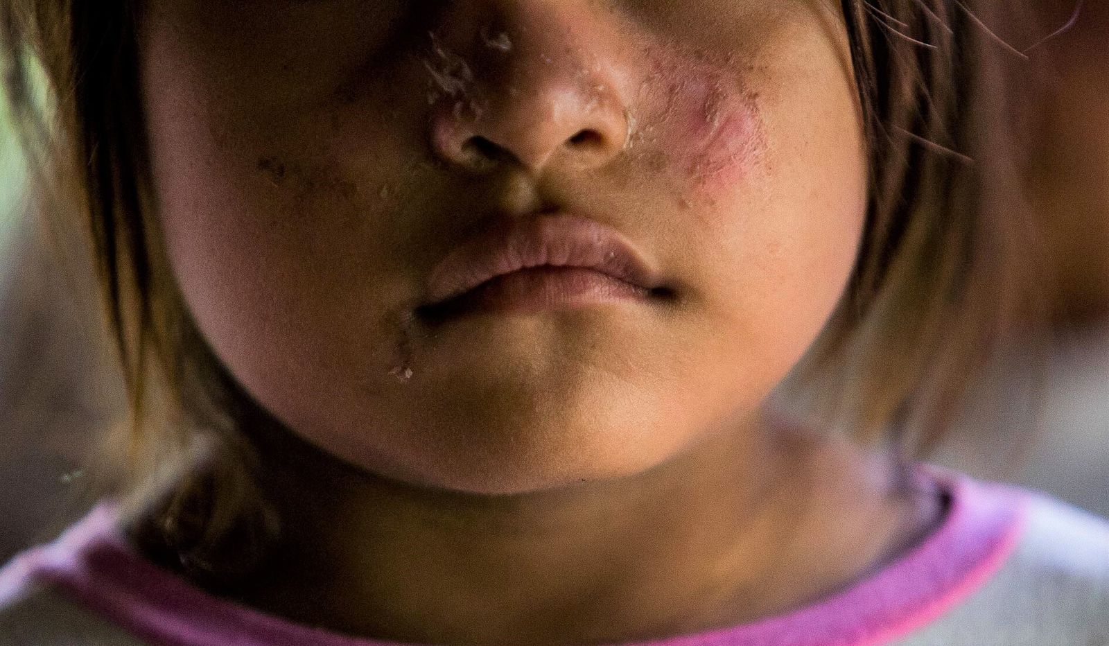 Niña indígena afectada por el derrame de petroleo. Foto Ivan Castaneira.