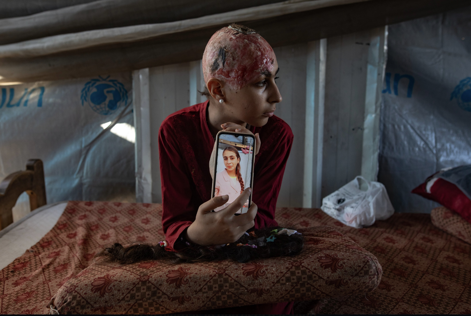 Hala Abu Dahlez, 12 años, una vida marcada por la guerra de Gaza