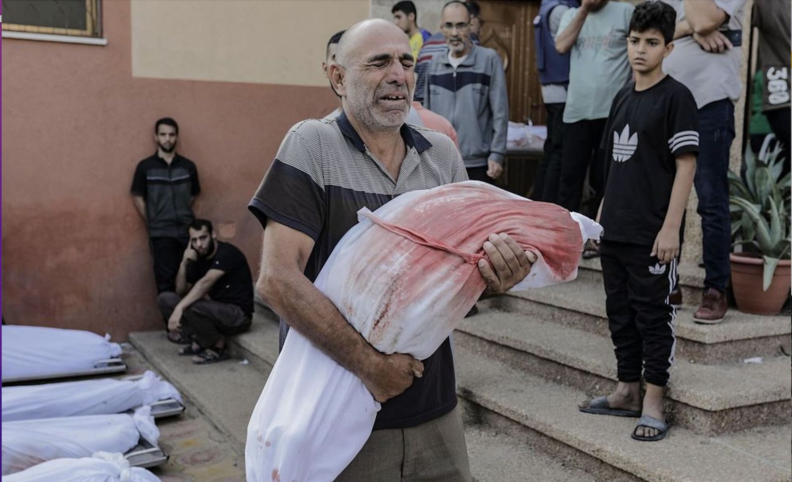 Un hombre con el cuerpo de un niño tras un ataque israelí en la guerra de Gaza